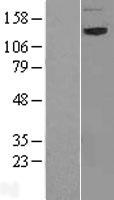 NBAS Human Over-expression Lysates NM_015909