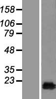CUTA Human Over-expression Lysates NM_001014837