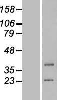 ls051601 lipt1 human over expression lysates nm 145199 wb testing 4