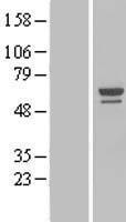NOP58 Human Over-expression Lysates NM_015934