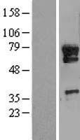 KIAA0859 (METTL13) Human Over-expression Lysates NM_015935