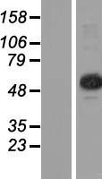TRMT6 Human Over-expression Lysates NM_015939
