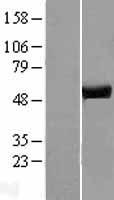 ATP6V1H Human Over-expression Lysates NM_213620