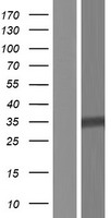 DPH5 Human Over-expression Lysates NM_001077395