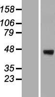 ERGIC3 Human Over-expression Lysates NM_198398