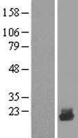 ls051619 ube2d4 human over expression lysates nm 015983 wb testing 1