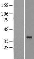 SLC25A39 Human Over-expression Lysates NM_016016