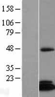 CIAO2B Human Over-expression Lysates NM_016062