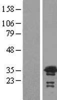 VPS24 (CHMP3) Human Over-expression Lysates NM_016079