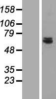 CDK5RAP1 Human Over-expression Lysates NM_016408