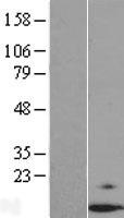 Dexras1 (RASD1) Human Over-expression Lysates NM_016084