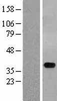 STYXL1 Human Over-expression Lysates NM_016086