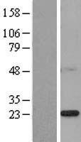 ls051659 psf2 gins2 human over expression lysates nm 016095 wb testing 1