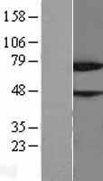 NYREN18 (NUB1) Human Over-expression Lysates NM_016118