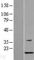 C1orf41 (HSPB11) Human Over-expression Lysates NM_016126