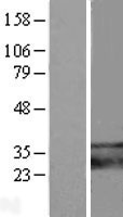 TMEM66 (SARAF) Human Over-expression Lysates NM_016127