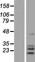 TPPP3 Human Over-expression Lysates NM_016140