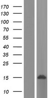 ls051691 lsm8 human over expression lysates nm 016200 wb testing 1