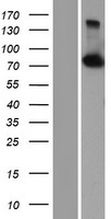 CPSF73 (CPSF3) Human Over-expression Lysates NM_016207