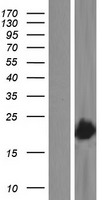 VPS29 Human Over-expression Lysates NM_016226