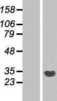 CYB5R2 Human Over-expression Lysates NM_016229