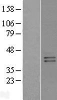 GPRC5B Human Over-expression Lysates NM_016235