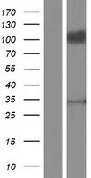 Endomucin (EMCN) Human Over-expression Lysates NM_001159694