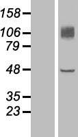 Endomucin (EMCN) Human Over-expression Lysates NM_016242