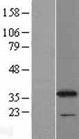 CYB5R1 Human Over-expression Lysates NM_016243