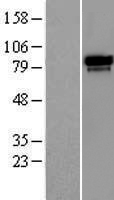 RAP80 (UIMC1) Human Over-expression Lysates NM_016290