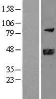 DNAJB11 Human Over-expression Lysates NM_016306