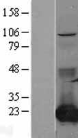 CMPK1 Human Over-expression Lysates NM_016308