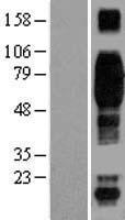 CD244 Human Over-expression Lysates NM_016382