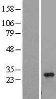 ls051762 rab8b human over expression lysates nm 016530 wb testing 1