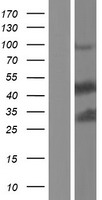 MST4 (STK26) Human Over-expression Lysates NM_001042452