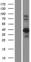 MST4 (STK26) Human Over-expression Lysates NM_001042453