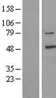 ls051776 zak map3k20 human over expression lysates nm 133646 wb testing 3