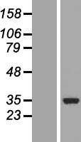 COQ3 Human Over-expression Lysates NM_017421