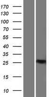 CTIP1 (BCL11A) Human Over-expression Lysates NM_138559