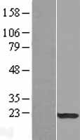 SP17 (SPA17) Human Over-expression Lysates NM_017425