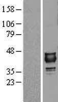 NUDT9 Human Over-expression Lysates NM_024047