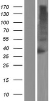 TM6SF1 Human Over-expression Lysates NM_001144903