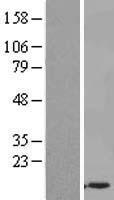 UBASH3A Human Over-expression Lysates NM_001001895
