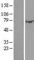 UBASH3A Human Over-expression Lysates NM_018961