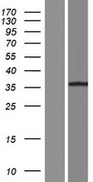 PANK1 Human Over-expression Lysates NM_138316