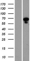 PANK1 Human Over-expression Lysates NM_148977