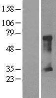 CLIC5 Human Over-expression Lysates NM_016929