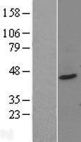 PTOV1 Human Over-expression Lysates NM_017432