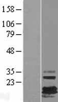 FXYD7 Human Over-expression Lysates NM_022006