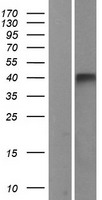 GPR86 (P2RY13) Human Over-expression Lysates NM_023914